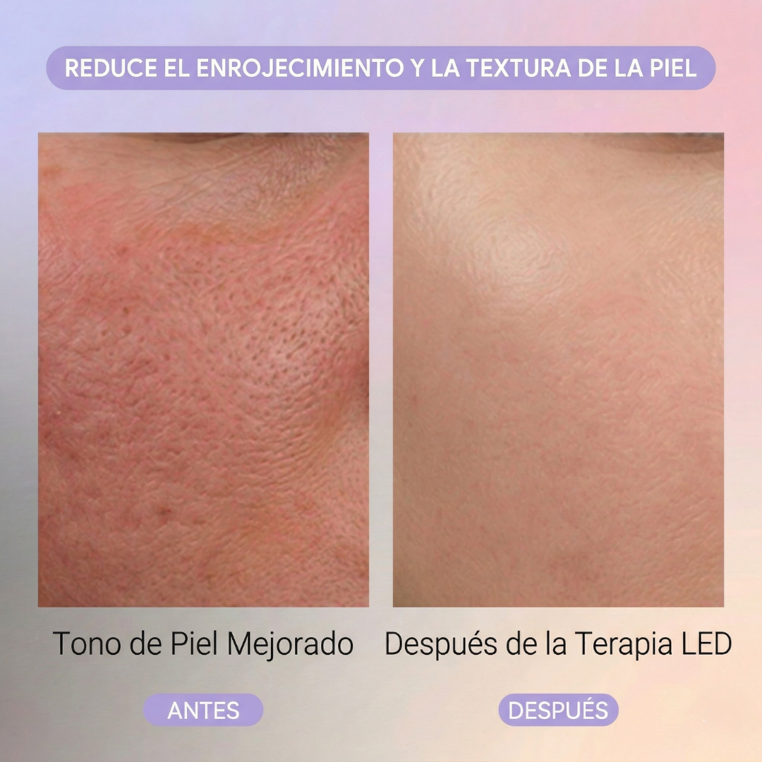 Lumeva Skin™ Máscara LED Facial. Ilumina y Renueva